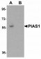 PIAS1 Antibody (C-Terminus)